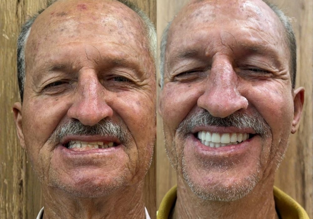 antes-e-depois (1)
