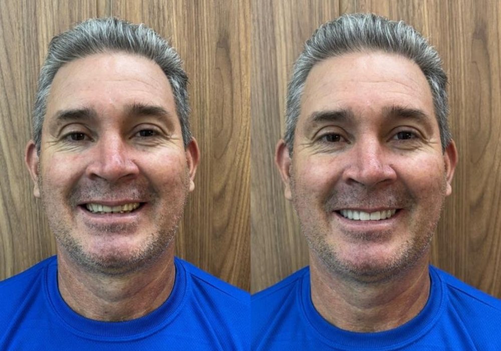 antes-e-depois (2)