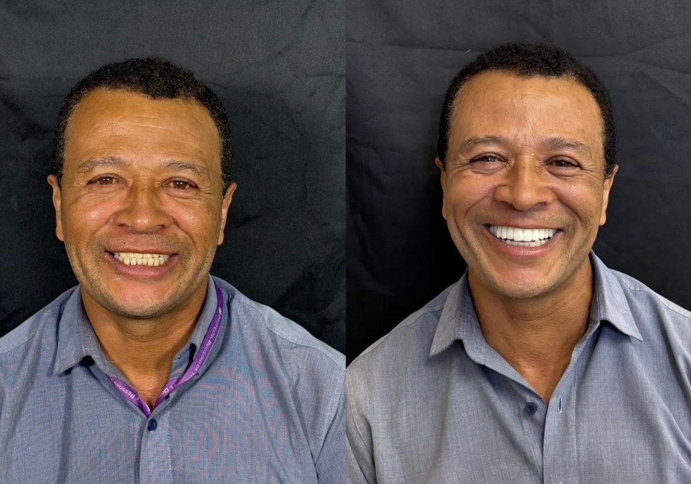 antes-e-depois
